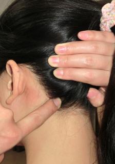 <p>图片中为哪个穴位</p>