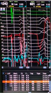 <p>根据室早图形，选择最有可能的室早起源位置 </p>