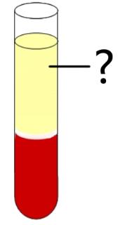 <p>请观察血液成分试管&#xff0c;指出该成分的名称&#xff1a;</p>
