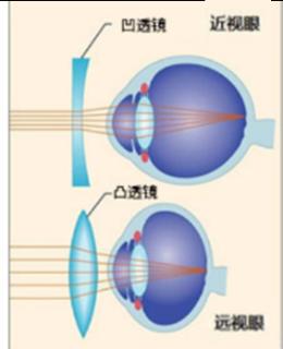 <p>佳佳发现奶奶戴的老花眼镜和他的近视眼镜的镜片完全不一样，观察发现近视眼镜是凹透镜，老花镜镜片的特点是</p>