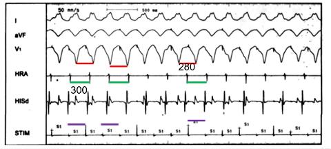 <p>关于图中VOP描述错误的是？</p>