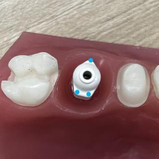 <p>种植扫描时，扫描杆的 顶端横截面和标记点 必须要扫到？</p>