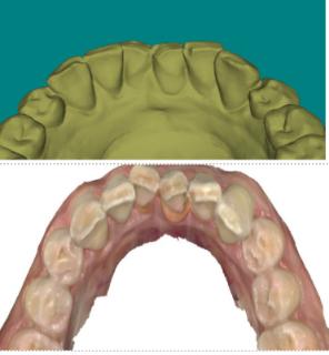 <p>该模型修整存在什么问题 ？</p>