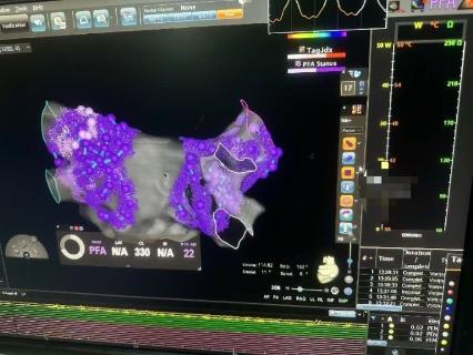 <p><strong>下图中未显示的工具有</strong></p>