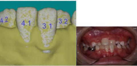 <p>该方案存在的错误？</p>