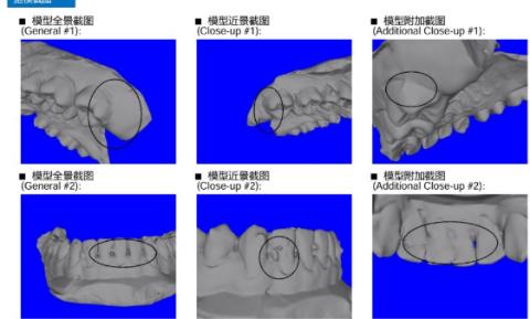 <p>此模型是否需要拒模 ?</p>