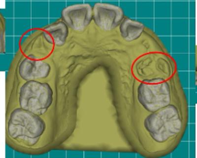 <p>以下模型存在的问题?</p>