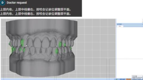 <p>IOS模型,医生指令要求“按咬合记录位调整颌平面”以下操作正确的是?</p>