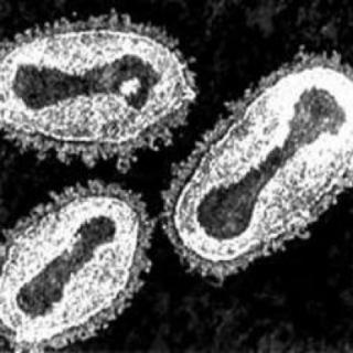 Disease was a part of ColumbianExchange.
