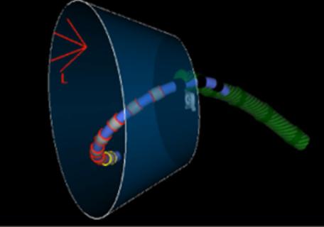 <p><strong>下图进行的PFA 手术操作是</strong></p>