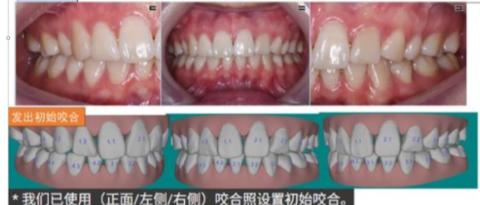 <p>（多选）该模型存在的问题?</p>