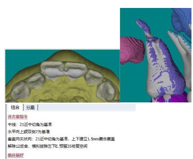 <p>（多选）以下模型存在什么问题？</p>
