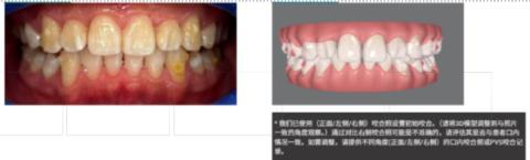 <p>（多选）该模型存在的问题？</p>