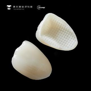 <p>泰利斯煜瓷修复冠质保期是多久&#xff1f;</p>