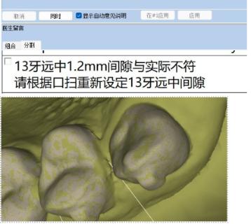 <p>该模型存在什么问题？</p>