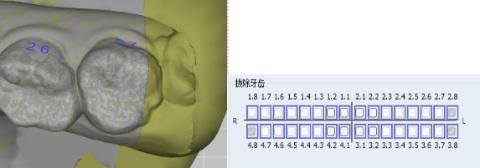 <p>以下切牙操作是否正确？</p>