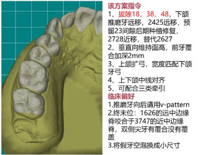 <p>该方案应该如何正确操作？</p>