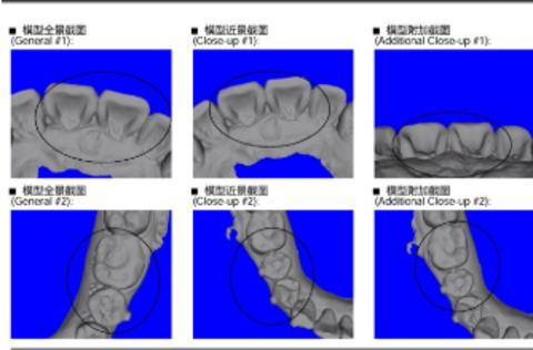 <p>以下方案是否需要拒模？</p>