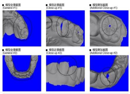 <p>以下方案是否需要拒模?</p>