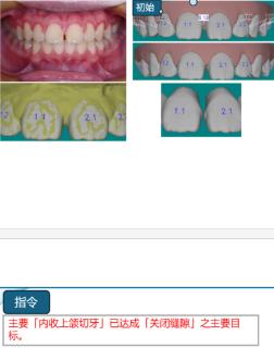 <p>该模型存在的问题？</p>