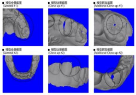 <p>以下方案是否需要拒模？</p>