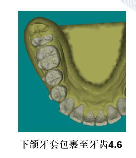 <p>该方案切牙是否正确</p>